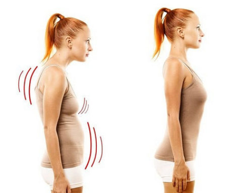 Get rid of that hunched posture through Rolfing sessions